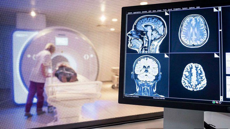 Problemas neurológicos en pacientes de COVID