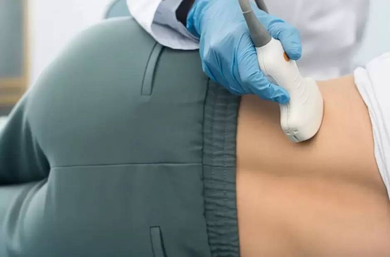 Insólito: fue al médico por un dolor de espalda y descubrieron que tenía tres riñones