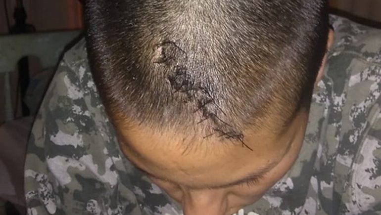 Le rompieron la cabeza de un piedrazo, estuvo en coma y vive para contarlo