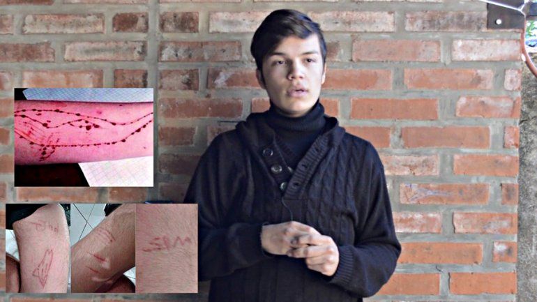 La imagen muestra los daños que pueden hacerse en los brazos. (Youtube)