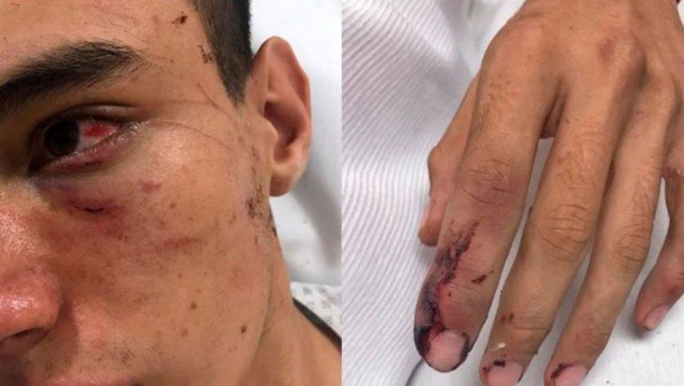 Golpean a rugbier y lo vinculan al crimen de Fernando