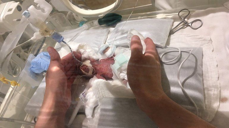 Milagro de vida: nació con 268 gramos y ya le dieron el alta