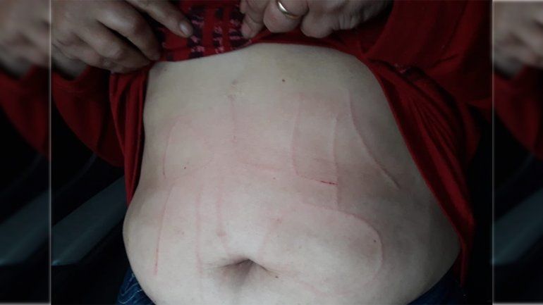 Secuestraron y torturaron a una maestra de Moreno: le inscribieron en el abdomen ollas no