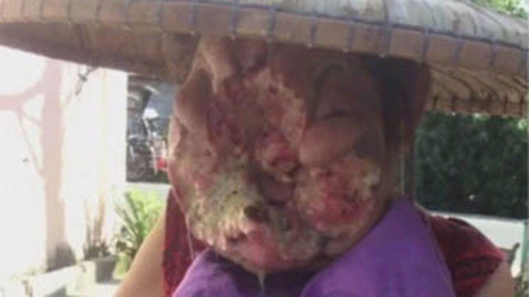 Sufre una infección que le deformó la cara y pide ayuda