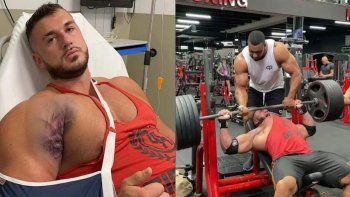 La cicatriz tras la operación de Crowley, quien ya está de vuelta en el gimnasio. La cicatriz tras la operación de Crowley, quien ya está de vuelta en el gimnasio.