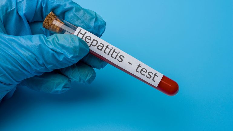 Hepatitis aguda infantil: detectan el primer caso en Argentina