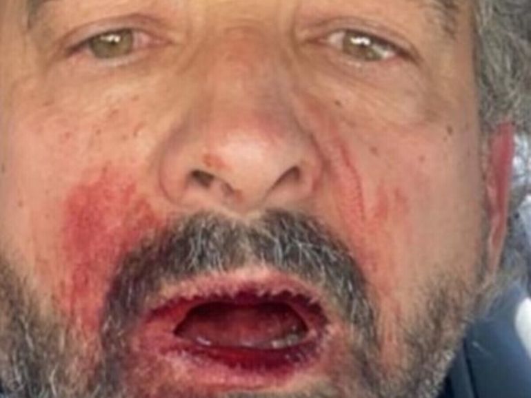 Chubut: agredieron a un exintendente de Puerto Pirámides. Chubut: agredieron a un exintendente de Puerto Pirámides.