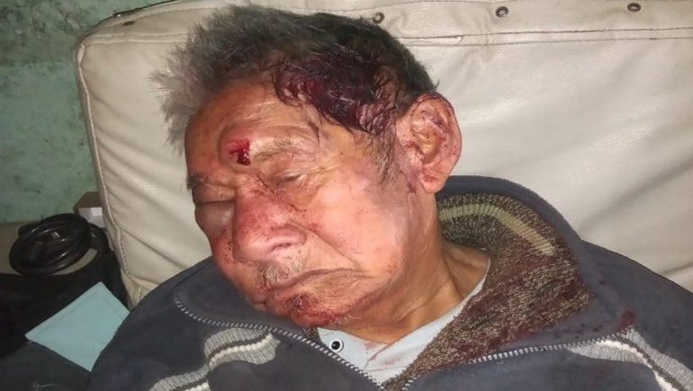 Antonio, un abuelo de 97 años, fue ferozmente atacado por los delincuentes que irrumpieron en su casa para robarle la jubilación.