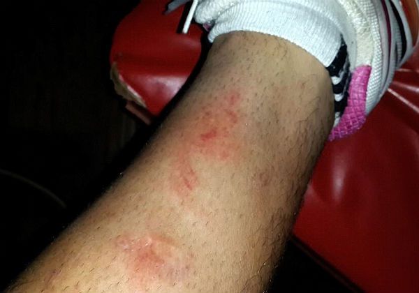 Gómez muestra foto de su pierna lastimada en el penal no cobrado