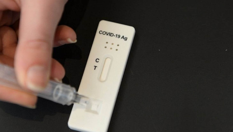 Farmacias neuquinas van a vender test rápidos de COVID