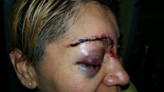 ataco a golpes a su mama y desfiguro a una sargento