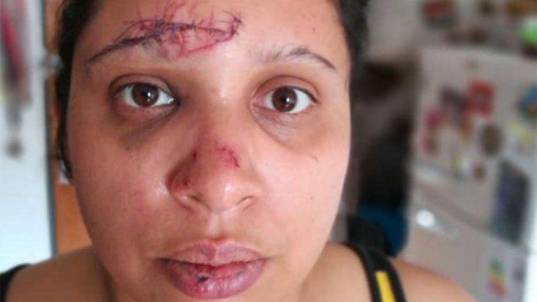 Casi matan a una repartidora por robarle el celular