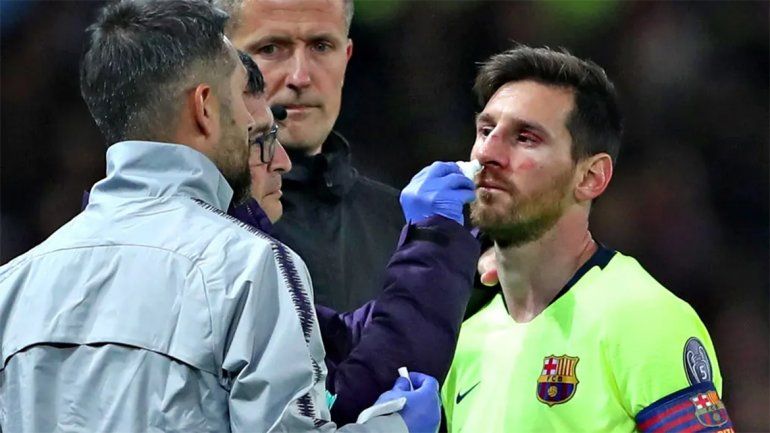 Video: así fue la dura falta contra Messi, que lo dejó con el rostro ensangrentado