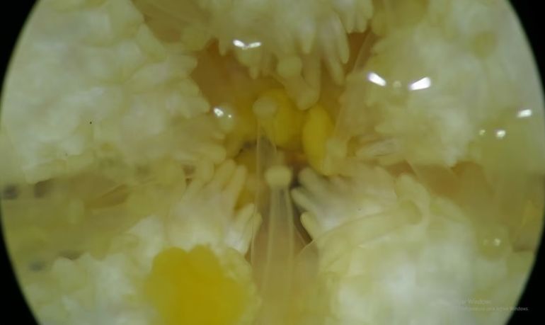 El período de incubación de la estrella de mar dura cuatro meses, de mayo a septiembre, según registraron los científicos del CONICET en las costas de Camarones, en Chubut. El período de incubación de la estrella de mar dura cuatro meses, de mayo a septiembre, según registraron los científicos del CONICET en las costas de Camarones, en Chubut.