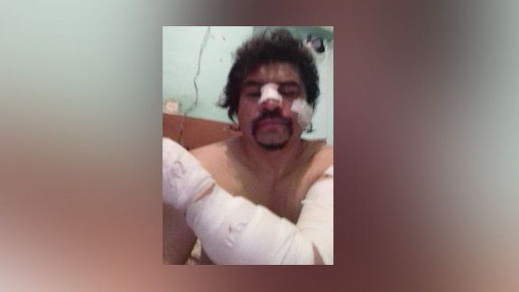 Brutal ataque a puñaladas un taxista en un confuso episodio