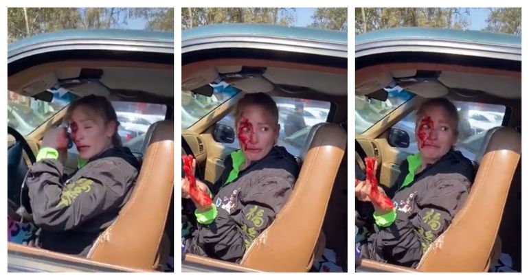 Así quedó el rostro de la conductora agredida por el influencer condenado en México. Así quedó el rostro de la conductora agredida por el influencer condenado en México.