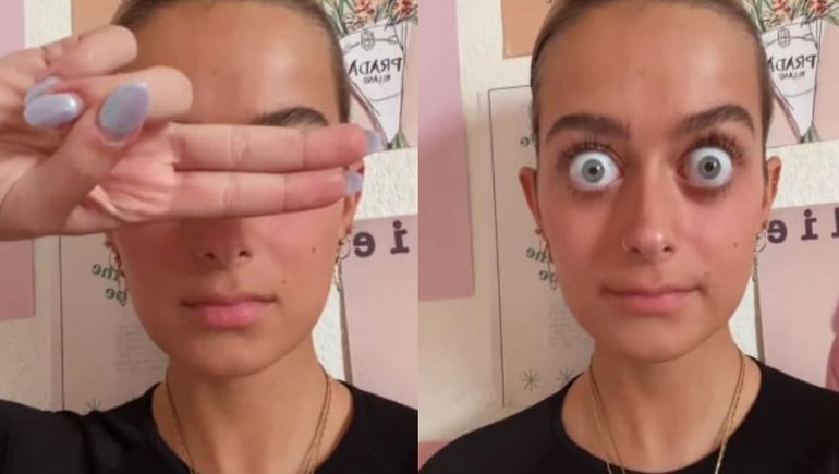 Una joven se vuelve viral por sus enormes ojos