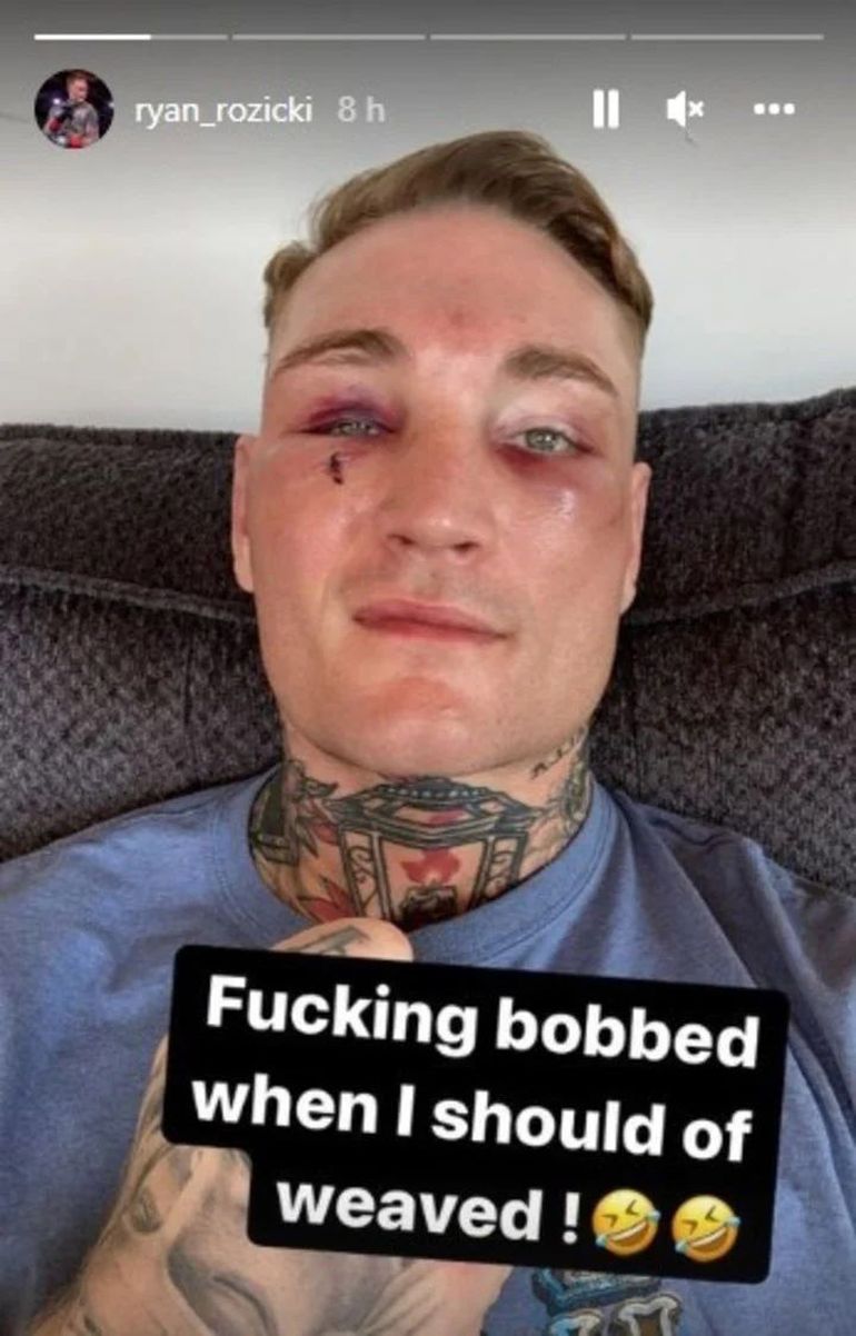 Así le quedó el rostro a Ryan Rozicki tras la paliza que le dio Yamil Peralta.