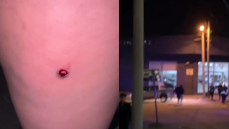 Una de las imágenes que circularon en las redes luego del uso de balas de goma por parte de la policía en Comodoro Rivadavia