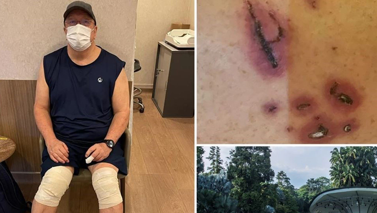 Unas nutrias lo mordieron 26 veces en diez segundos