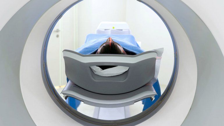 Detectan antes un cáncer con inteligencia artificial