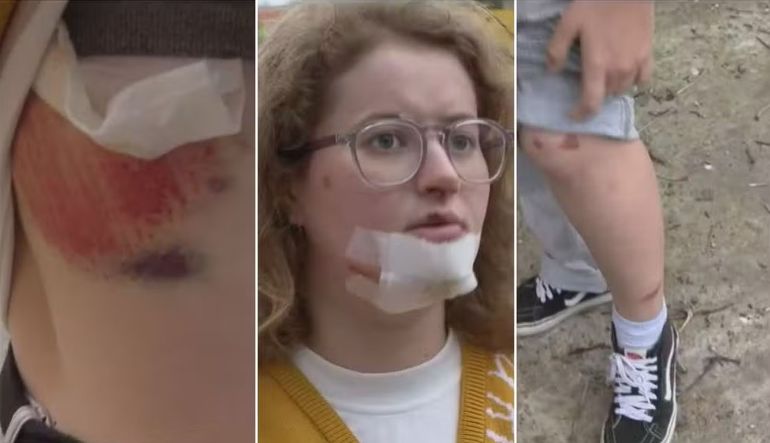 La mujer sufrió lesiones en la nariz, cortes en el labio y la barbilla, además de algunas contusiones. La mujer sufrió lesiones en la nariz, cortes en el labio y la barbilla, además de algunas contusiones.