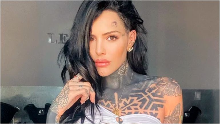 Cande Tinelli contó lo que sufrió al ponerse implantes en la cola