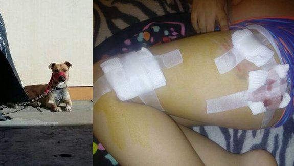 Otro nene fue atacado por un perro en las calles de Zapala