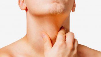 linfomas: un cancer que se puede curar pero requiere un diagnostico precoz linfomas: un cancer que se puede curar pero requiere un diagnostico precoz