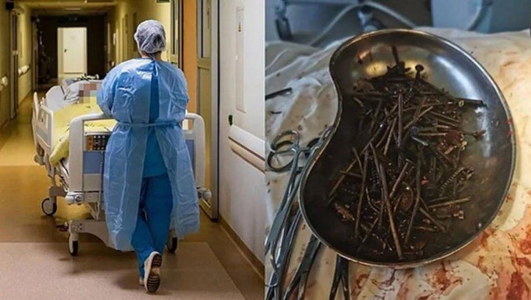 Le sacan más de un kilo de clavos del estómago