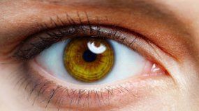 El agujero macular afecta la retina y la visión disminuye severamente.