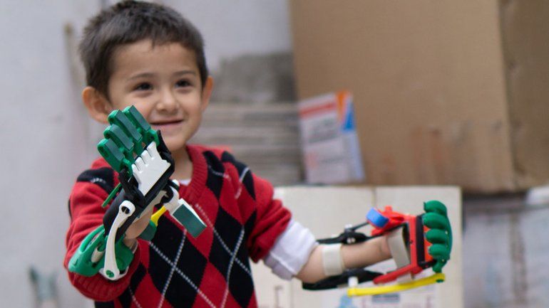 Entregarán prótesis de brazo y mano en Neuquén