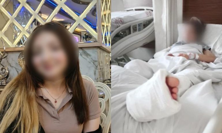 La adolescente sufrió una fractura y una fisura en una de sus piernas por la caída. La adolescente sufrió una fractura y una fisura en una de sus piernas por la caída.