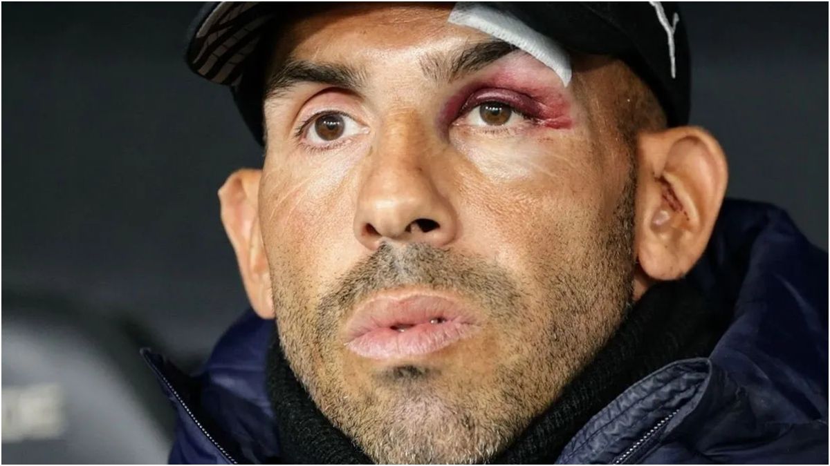 Carlos Tevez