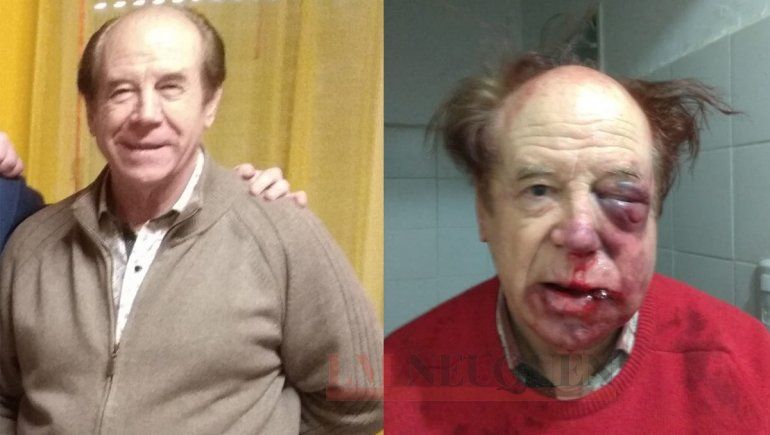 Al dueño de una inmobiliaria lo desfiguraron a golpes en un robo