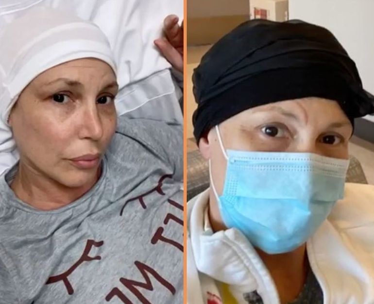 Celina comparte las fotos del proceso de su enfermedad para concientizar sobre la importancia de un diagnóstico temprano.