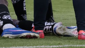 tras una falta de un defensor argentino, un jugador sufrio una escalofriante lesion: las imagenes tras una falta de un defensor argentino, un jugador sufrio una escalofriante lesion: las imagenes