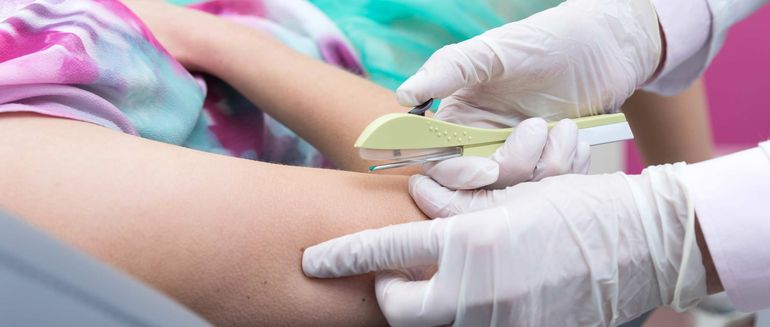 La implementación del implante subdérmico (conocido como chip) como método anticonceptivo, es uno de los más utilizados por las adolescentes de la provincia.