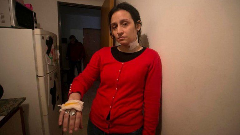 Una mujer denunció 12 veces a su ex por violencia