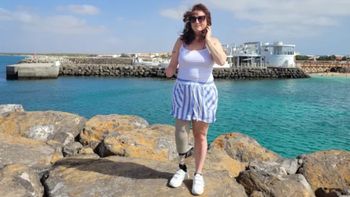 Por una enfermedad poco conocida, Gill Haddington sufrió la amputación de su pierna y su mano derechas Por una enfermedad poco conocida, Gill Haddington sufrió la amputación de su pierna y su mano derechas