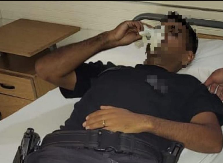 Por el cabezazo que le dio el detenido, el agente sufrió la fractura del tabique. La mujer policía quedó con un corte en la cara. Por el cabezazo que le dio el detenido, el agente sufrió la fractura del tabique. La mujer policía quedó con un corte en la cara. 