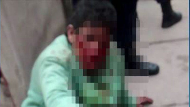 La Policía llegó justo y evitó que los vecinos mataran al ladrón.