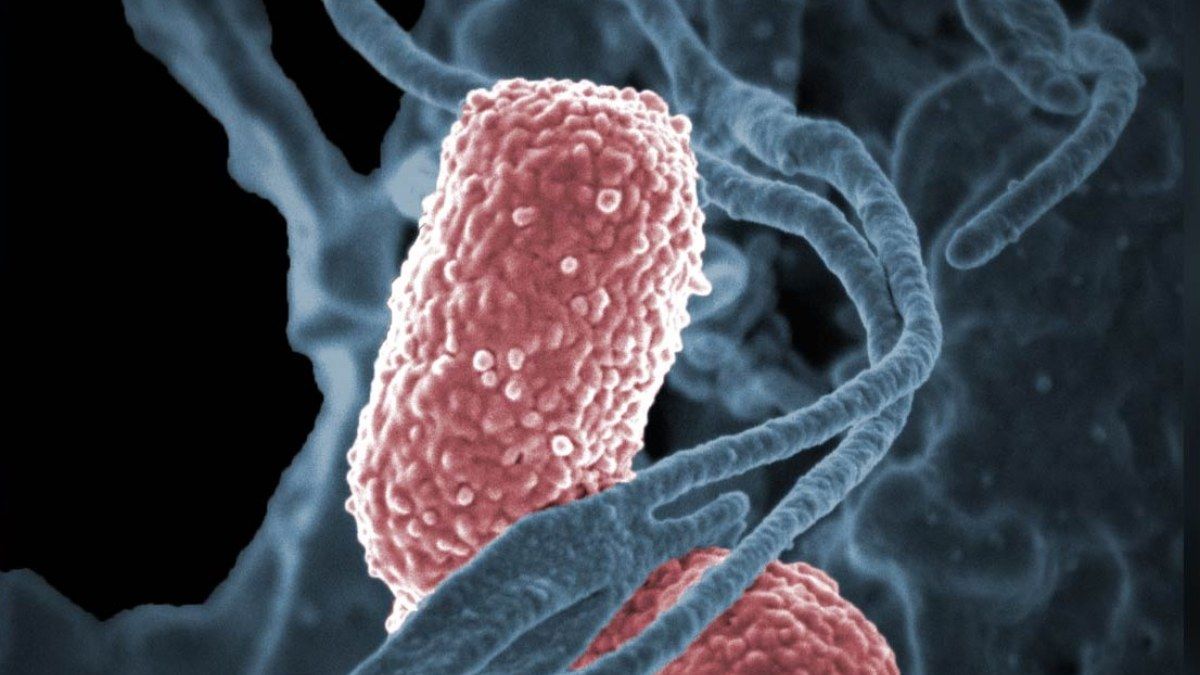 Alerta por bacteria resistente a todos los antibióticos thumbnail