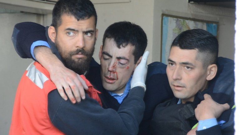Desde la clínica aseguran que el policía tiene comprometido el ojo izquierdo