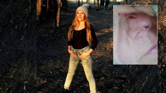 Mamá de una alumna atacó brutalmente a una profesora de danza: Me rompió la nariz