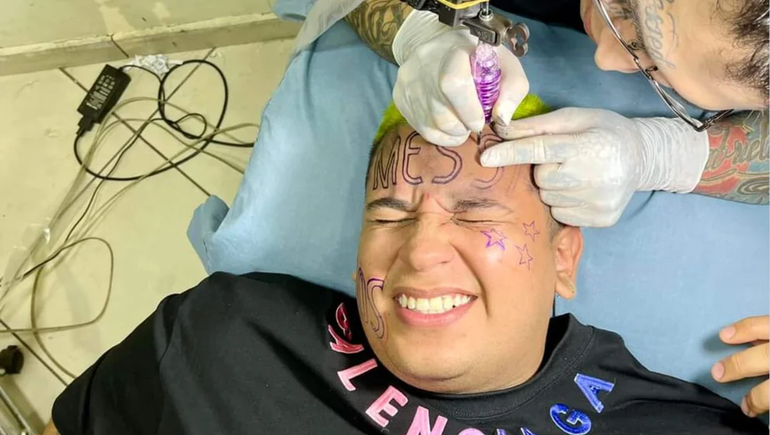 Hizo creer que se tatuó Messi en la frente y confesó que todo era mentira