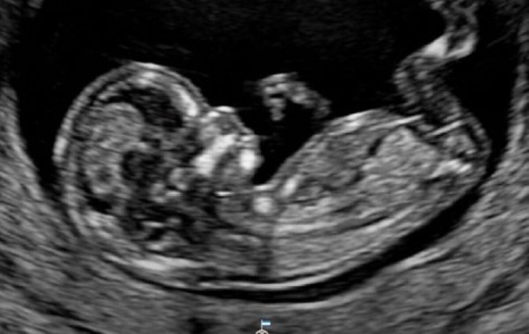 El polémico mensaje del Gobierno en defensa del Día del Niño por Nacer