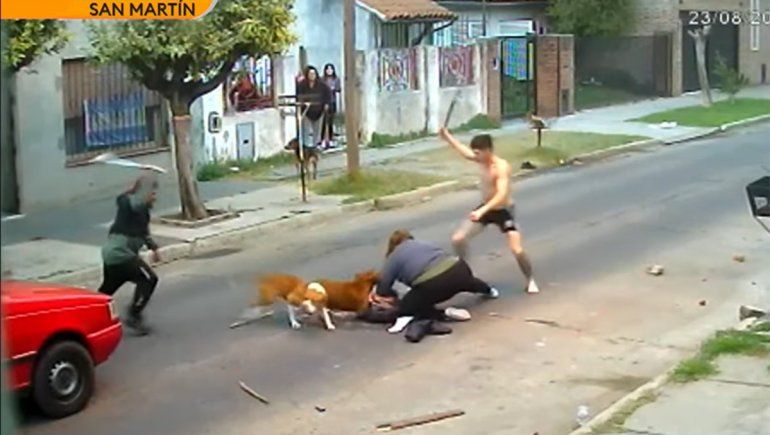 Buenos Aires: una mujer fue atacada ferozmente por tres perros