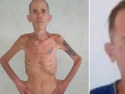 La imagen del opositor tras su liberación vuelve a poner el foco en las denuncias sobre las condiciones en cárceles de Cuba. La imagen del opositor tras su liberación vuelve a poner el foco en las denuncias sobre las condiciones en cárceles de Cuba.