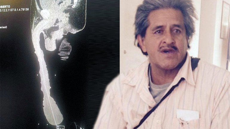 Roberto Cabrera posee un pene de 48 centímetros. No quiere operarse.
